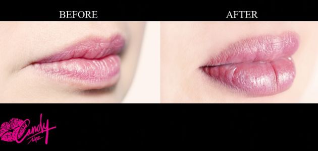 CandyLipz