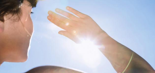 ostecenje-sunce