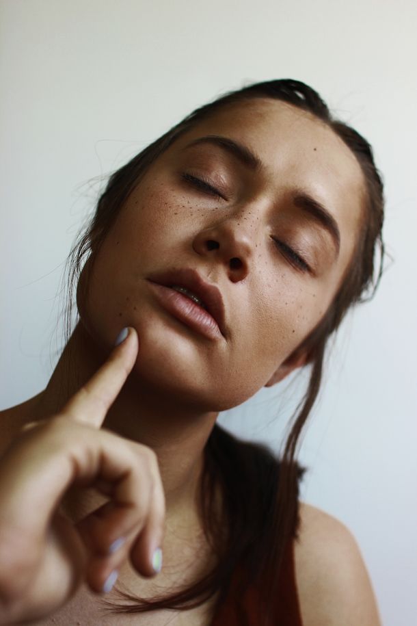 hiperpigmentacija žena pjege lice bauty