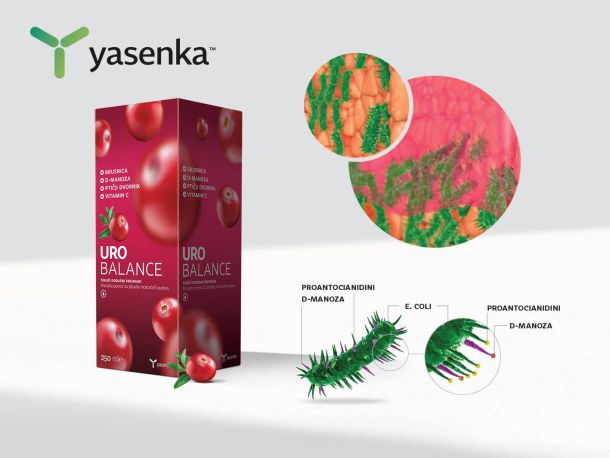 UroBalance slika6-2
