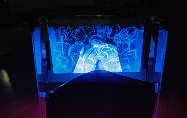 stidljivost-drveca-2