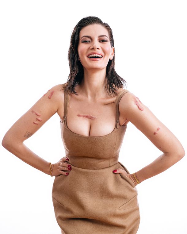 lana-bizelj