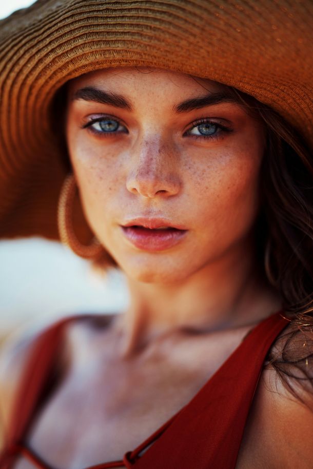 pigmentacijeke mrlje suncanje vitamin c
